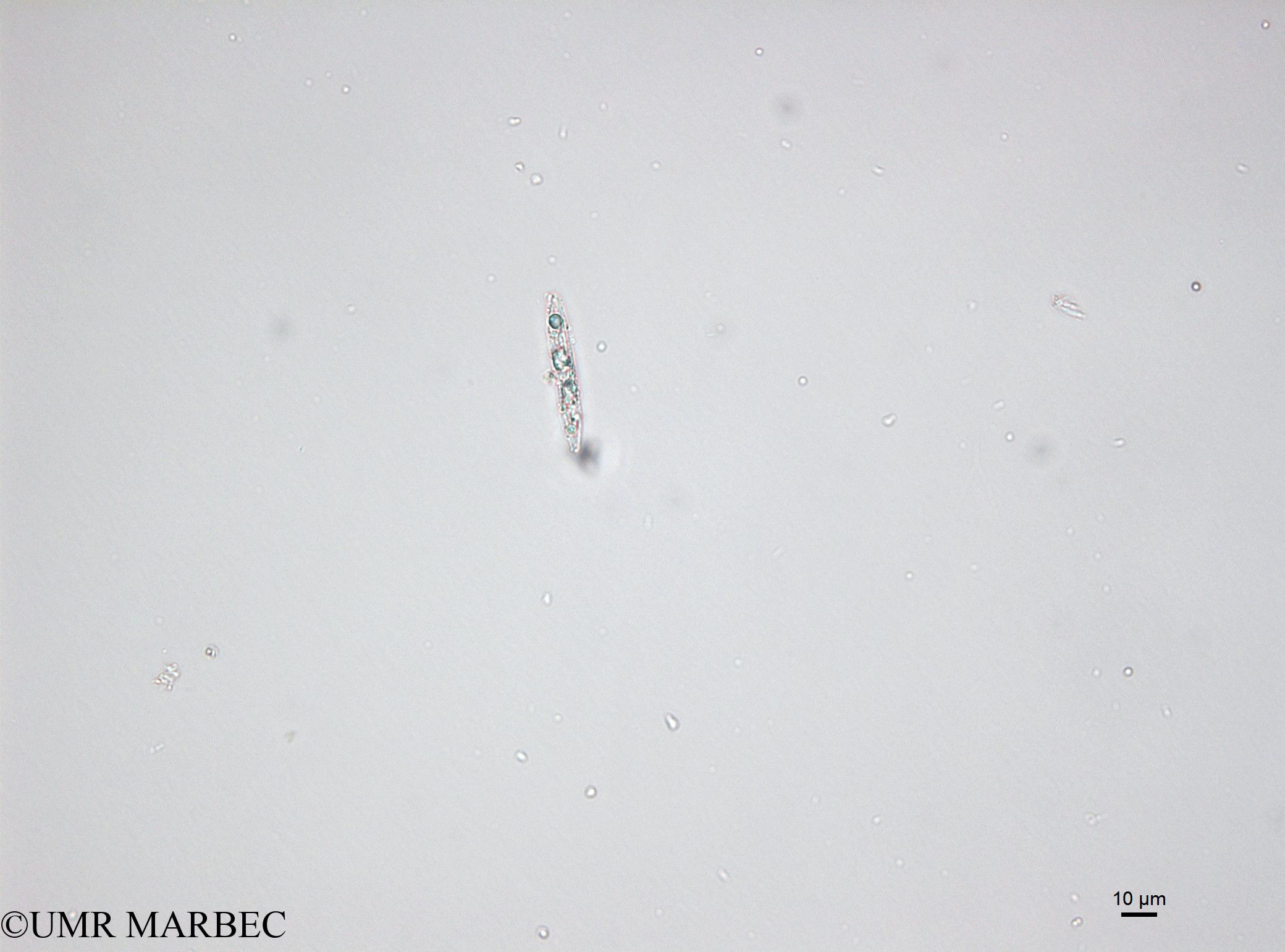 phyto/Bizerte/bizerte_lagoon/RISCO April 2014/Cymatopleura sp1 (150403_001_ovl-3).tif(copy).jpg